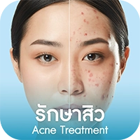 รักษาสิว