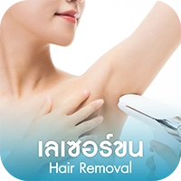 เลเซอร์ขน